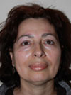 Facelift New York
