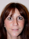 Facelift New York