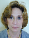 Facelift NYC