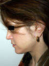 Facelift NYC