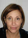 Facelift NYC