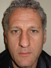 Rhinoplasty NYC