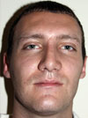Rhinoplasty in NYC