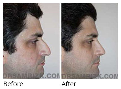 perfect nose shape men