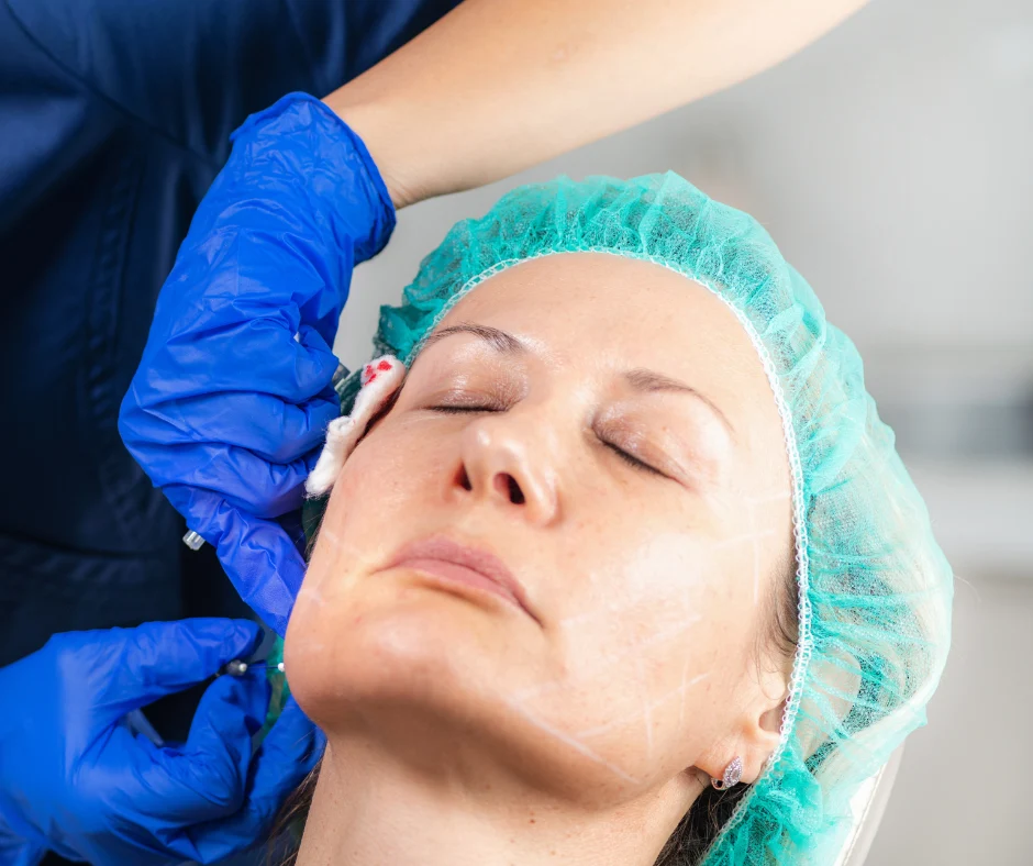 Female Being Prepared for Facelift Surgery